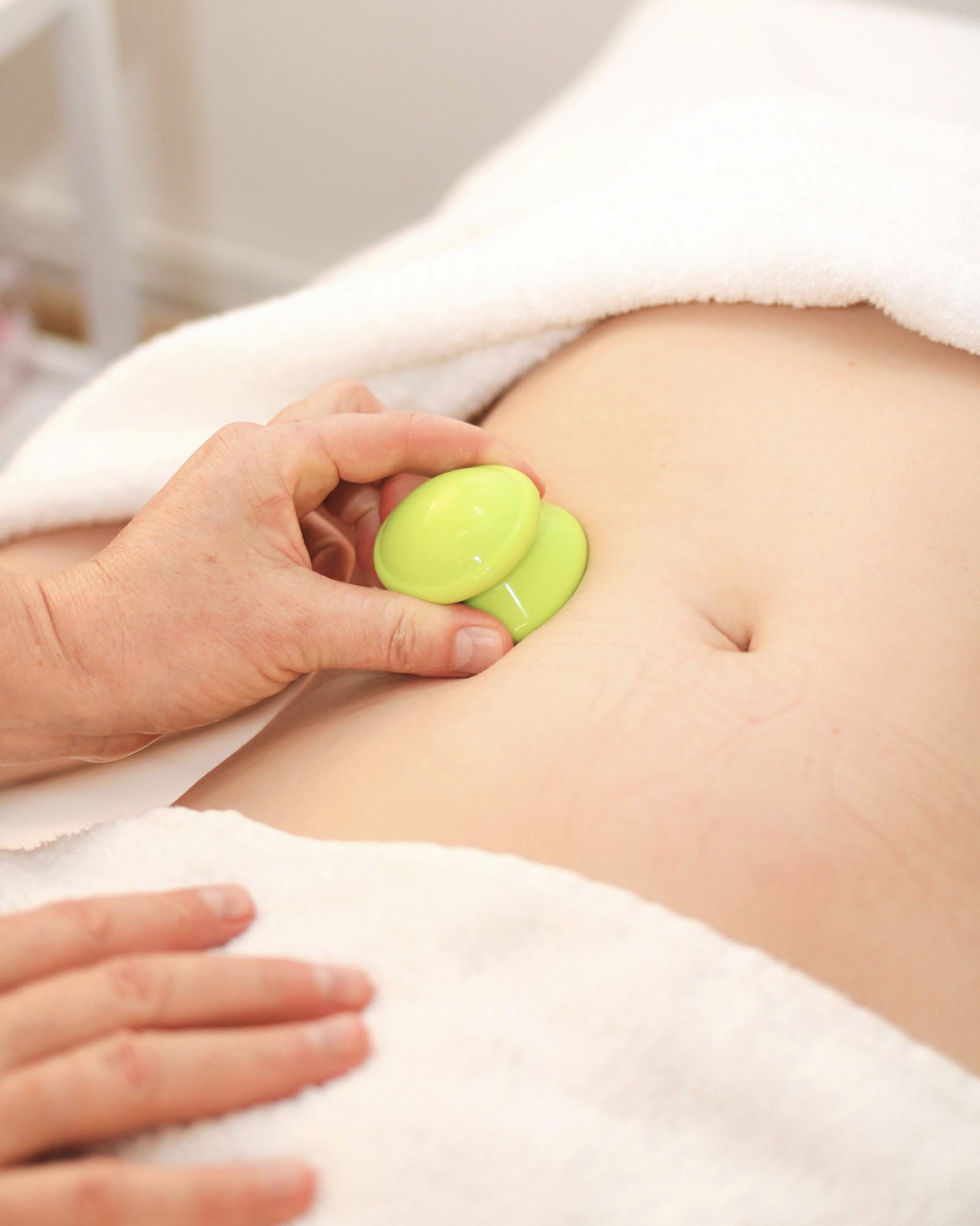 Silicone cupping therapy (abdomen)
